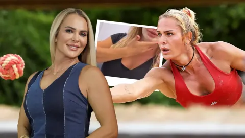 "Barbie gibi olacağım" diyerek ameliyat masasına yattı! Nagihan Karadere'nin estetik sonrası hali şaşırttı!