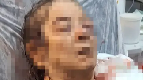 Evde otururken tavandan kopan moloz yığını altında kalan kadın yaralandı