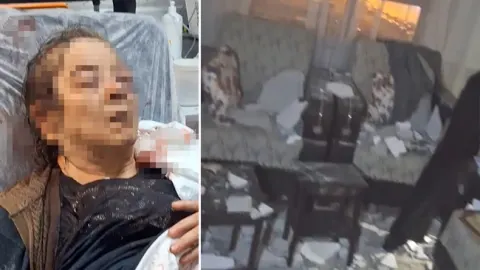 Evinde otururken üzerine tavan çöktü!