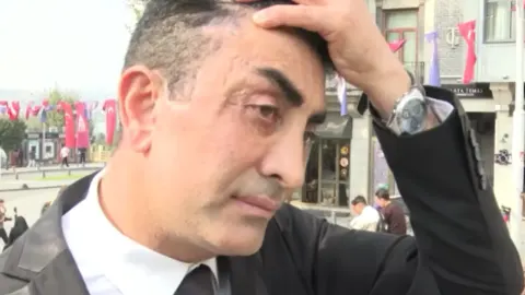 Genç görünme hayali kabusa dönüştü: 4 kez bıçak altına yattı