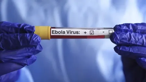Kenya'da Ebola vakası sayısı 8'e yükseldi